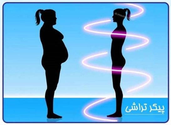 body contouring surgery in Iran