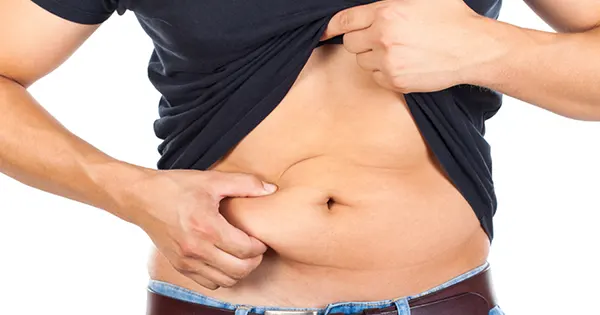 Abdominal liposuction in Iran